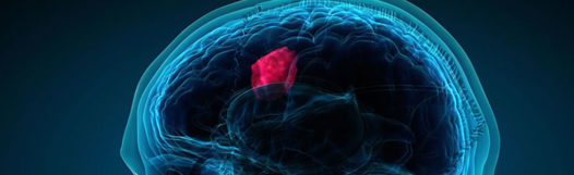 Brain and Skull Conditions