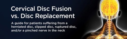 Neck Surgery Guide