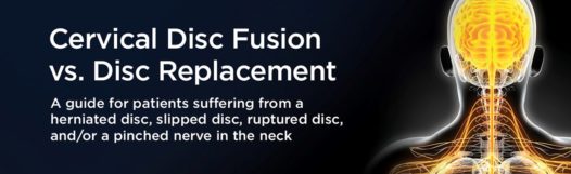 Neck Surgery Guide hero Neck Surgery Guide