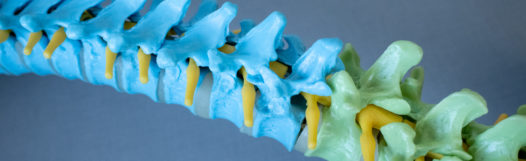 Spinal Fusion Patient Video Image Image of a model spinal cord in blue and green.