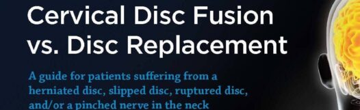 Cervical_Disc_Surgery_Options_Guide_CTA Cover Image for the downloadable guide -- Cervical Disc Fusion vs. Disc Replacement