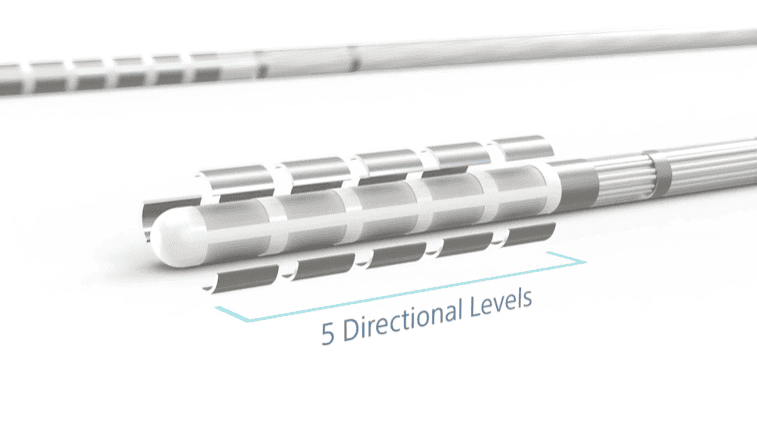 Directional leads are one form of advanced DBS technology improving outcomes.