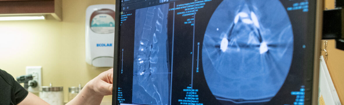 Do steroid injections work? Blog image Dr. Woodworth addresses patients pain and if epidural injections may help with back pain.